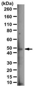 Anti-Lunapark Antibody serum, from rabbit