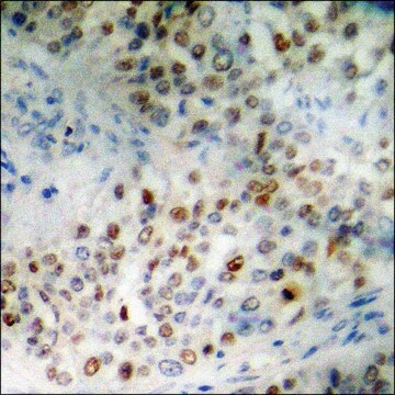 Anti-phospho-SP1 (pThr453) antibody produced in rabbit affinity isolated antibody