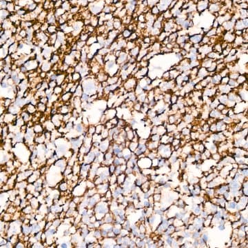 Anti-CD35/CR1 Antibody, clone 2A0Q1, Rabbit Monoclonal