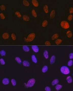 Anti-SMARCA5/SNF2H antibody produced in rabbit