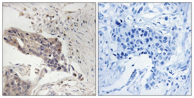 Anti-SLP-76 antibody produced in rabbit affinity isolated antibody