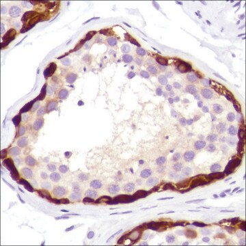 Anti-MAGE-A1 antibody, Rabbit monoclonal clone SP194, recombinant, expressed in proprietary host, affinity isolated antibody