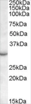 Anti-RAB23 antibody produced in goat affinity isolated antibody, buffered aqueous solution