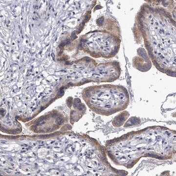 Anti-SLC13A4 antibody produced in rabbit Prestige Antibodies&#174; Powered by Atlas Antibodies, affinity isolated antibody, buffered aqueous glycerol solution