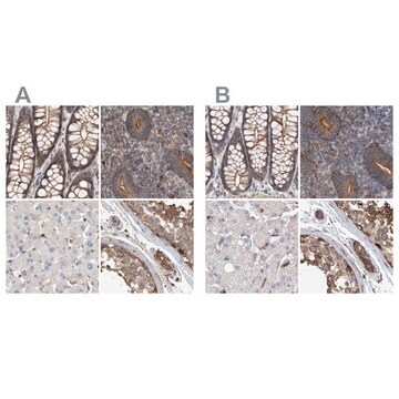 Anti-SPECC1 antibody produced in rabbit Prestige Antibodies&#174; Powered by Atlas Antibodies, affinity isolated antibody, buffered aqueous glycerol solution, Ab2