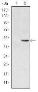 Monoclonal Anti-MTHFR antibody produced in mouse clone 5D3, ascites fluid