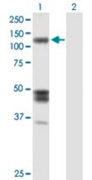 Anti-IARS antibody produced in mouse IgG fraction of antiserum, buffered aqueous solution