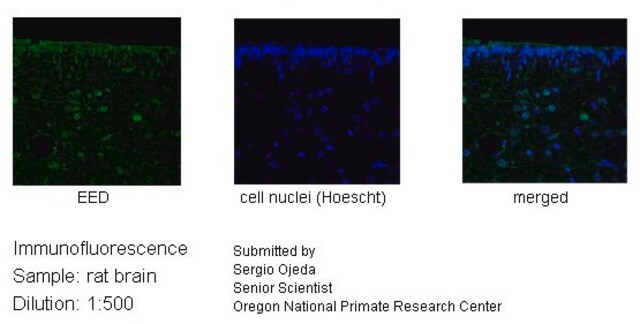 Anti-EED, (N-terminal) antibody produced in rabbit affinity isolated antibody