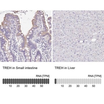 Anti-TREH antibody produced in rabbit Prestige Antibodies&#174; Powered by Atlas Antibodies, affinity isolated antibody, buffered aqueous glycerol solution