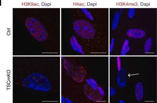 ChIPAb+ Trimethyl-Histone H3 (Lys4) - przeciwciało z walidacją ChIP i zestaw primerów, królicze monoklonalne from rabbit