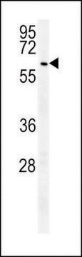 ANTI-UBP17(C-TERMINAL) antibody produced in rabbit affinity isolated antibody, buffered aqueous solution