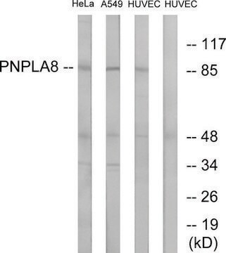 Anti-PNPLA8 antibody produced in rabbit affinity isolated antibody