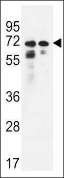 ANTI-PNPLA8(N-TERMINAL) antibody produced in rabbit affinity isolated antibody, buffered aqueous solution