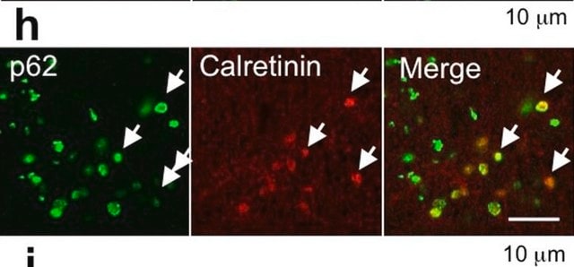 Anticuerpo anti-calretinina, clon 6B8.2 clone 6B8.2, Chemicon&#174;, from mouse