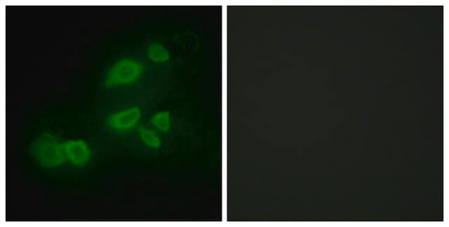 Anti-CDCP1 antibody produced in rabbit affinity isolated antibody