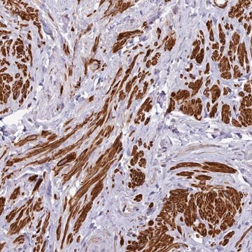 Anti-NLRC4 antibody produced in rabbit Prestige Antibodies&#174; Powered by Atlas Antibodies, affinity isolated antibody, buffered aqueous glycerol solution