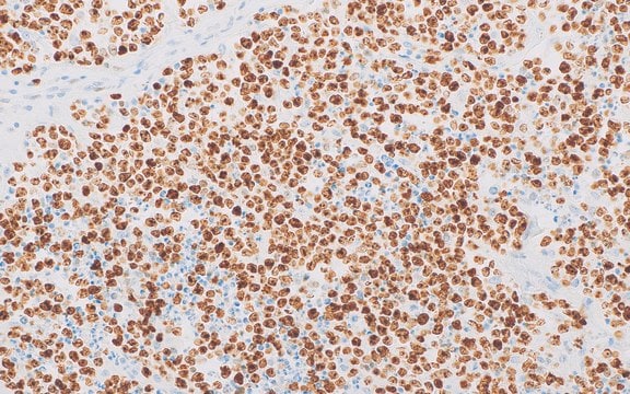 Ki-67 (MRQ-64) Rabbit Monoclonal Antibody clone MRQ-64, unconjugated, Cell Marque&#8482;