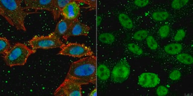 Anti-YL-1 Antibody, clone EX-1Y32 clone EX-1Y32, from mouse