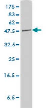 Anti-PLTP Mouse mAb (2F3-G4) liquid, clone 2F3-G4, Calbiochem&#174;