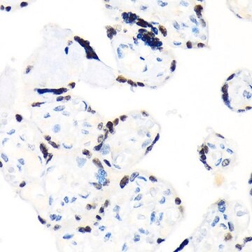 Anti-RCC1 antibody produced in rabbit