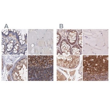 Anti-ANKRD13A antibody produced in rabbit Prestige Antibodies&#174; Powered by Atlas Antibodies, affinity isolated antibody, buffered aqueous glycerol solution