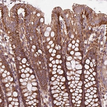 Anti-PLEKHD1 antibody produced in rabbit Prestige Antibodies&#174; Powered by Atlas Antibodies, affinity isolated antibody, buffered aqueous glycerol solution