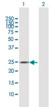 Anti-AGPAT2 antibody produced in rabbit purified immunoglobulin, buffered aqueous solution