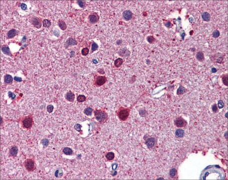 Anti-RARB antibody produced in rabbit affinity isolated antibody