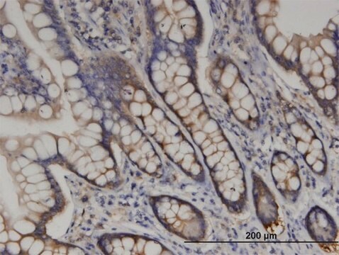 Monoclonal Anti-RARS antibody produced in mouse clone 1A2, purified immunoglobulin, buffered aqueous solution