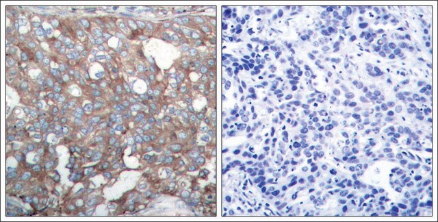 Anti-CTTN (Ab-421) antibody produced in rabbit affinity isolated antibody