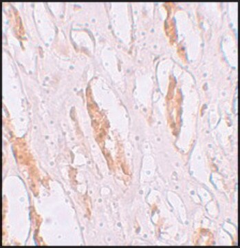 Anti-ZIP1 antibody produced in rabbit affinity isolated antibody, buffered aqueous solution