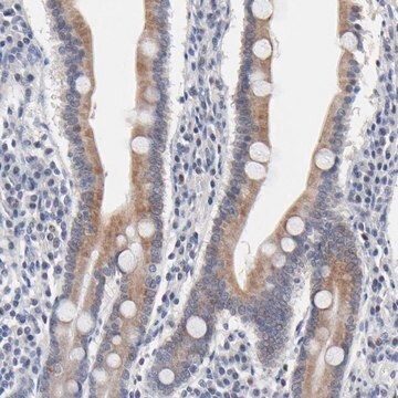 Anti-AADAC antibody produced in rabbit Prestige Antibodies&#174; Powered by Atlas Antibodies, affinity isolated antibody, buffered aqueous glycerol solution