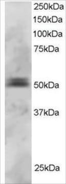 Anti-PAX5/BSAP antibody produced in goat affinity isolated antibody, buffered aqueous solution