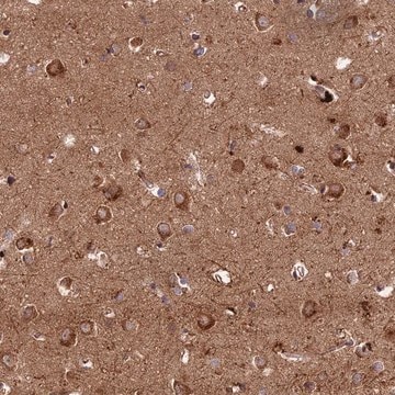 Anti-KIAA1468 antibody produced in rabbit Prestige Antibodies&#174; Powered by Atlas Antibodies, affinity isolated antibody, buffered aqueous glycerol solution