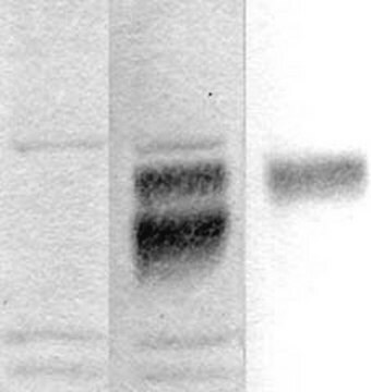 Anti-Amyloid-Vorläuferprotein-Antikörper, KPI-Domäne serum, Chemicon&#174;