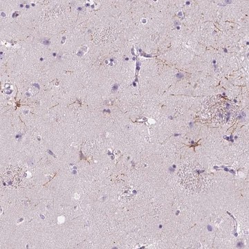 Anti-MYH15 antibody produced in rabbit Prestige Antibodies&#174; Powered by Atlas Antibodies, affinity isolated antibody, buffered aqueous glycerol solution