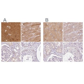 Anti-CAP2 antibody produced in rabbit Prestige Antibodies&#174; Powered by Atlas Antibodies, affinity isolated antibody, buffered aqueous glycerol solution