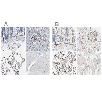 Anti-CD93 antibody produced in rabbit Prestige Antibodies&#174; Powered by Atlas Antibodies, affinity isolated antibody, buffered aqueous glycerol solution