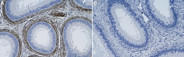 Anti-LTBP4 Antibody, clone 2M8 ZooMAb&#174; Rabbit Monoclonal recombinant, expressed in HEK 293 cells