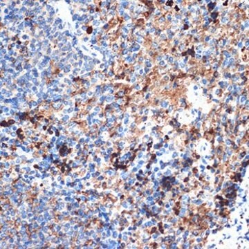 Anti-CRMP5/DPYSL5 antibody produced in rabbit