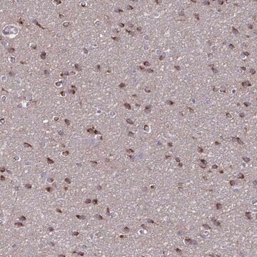 Anti-NUMBL antibody produced in rabbit Prestige Antibodies&#174; Powered by Atlas Antibodies, affinity isolated antibody, buffered aqueous glycerol solution