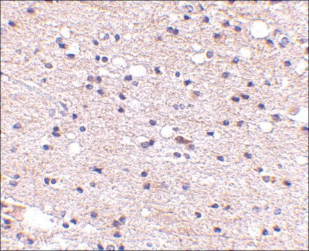 Anti-Ambra1 (ab1) antibody produced in rabbit affinity isolated antibody, buffered aqueous solution