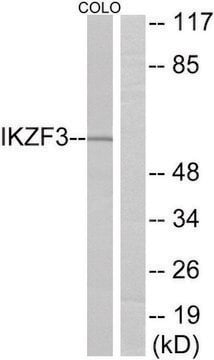 抗IKZF3抗体 ウサギ宿主抗体 affinity isolated antibody