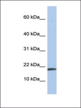 Anti-IL1A antibody produced in rabbit affinity isolated antibody