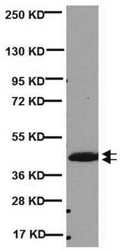 Anticorps anti-CNPase, clone&nbsp;11-5B clone 11-5B, Chemicon&#174;, from mouse