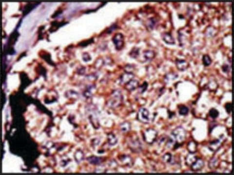 Anti-DGKB (C-term) antibody produced in rabbit IgG fraction of antiserum, buffered aqueous solution