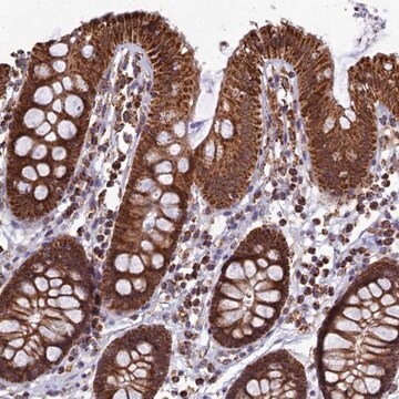 Anti-SPR antibody produced in rabbit Prestige Antibodies&#174; Powered by Atlas Antibodies, affinity isolated antibody, buffered aqueous glycerol solution