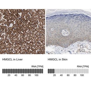 Anti-HMGCL antibody produced in rabbit Prestige Antibodies&#174; Powered by Atlas Antibodies, affinity isolated antibody, buffered aqueous glycerol solution