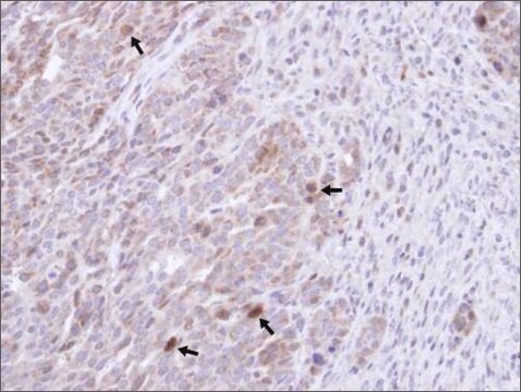 Anti-GRB14 antibody produced in rabbit affinity isolated antibody, buffered aqueous solution