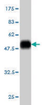 Monoclonal Anti-SLC45A2 antibody produced in mouse clone 2F4, purified immunoglobulin, buffered aqueous solution